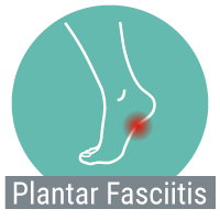 Plantar Fasciitis