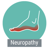 Neuropathy