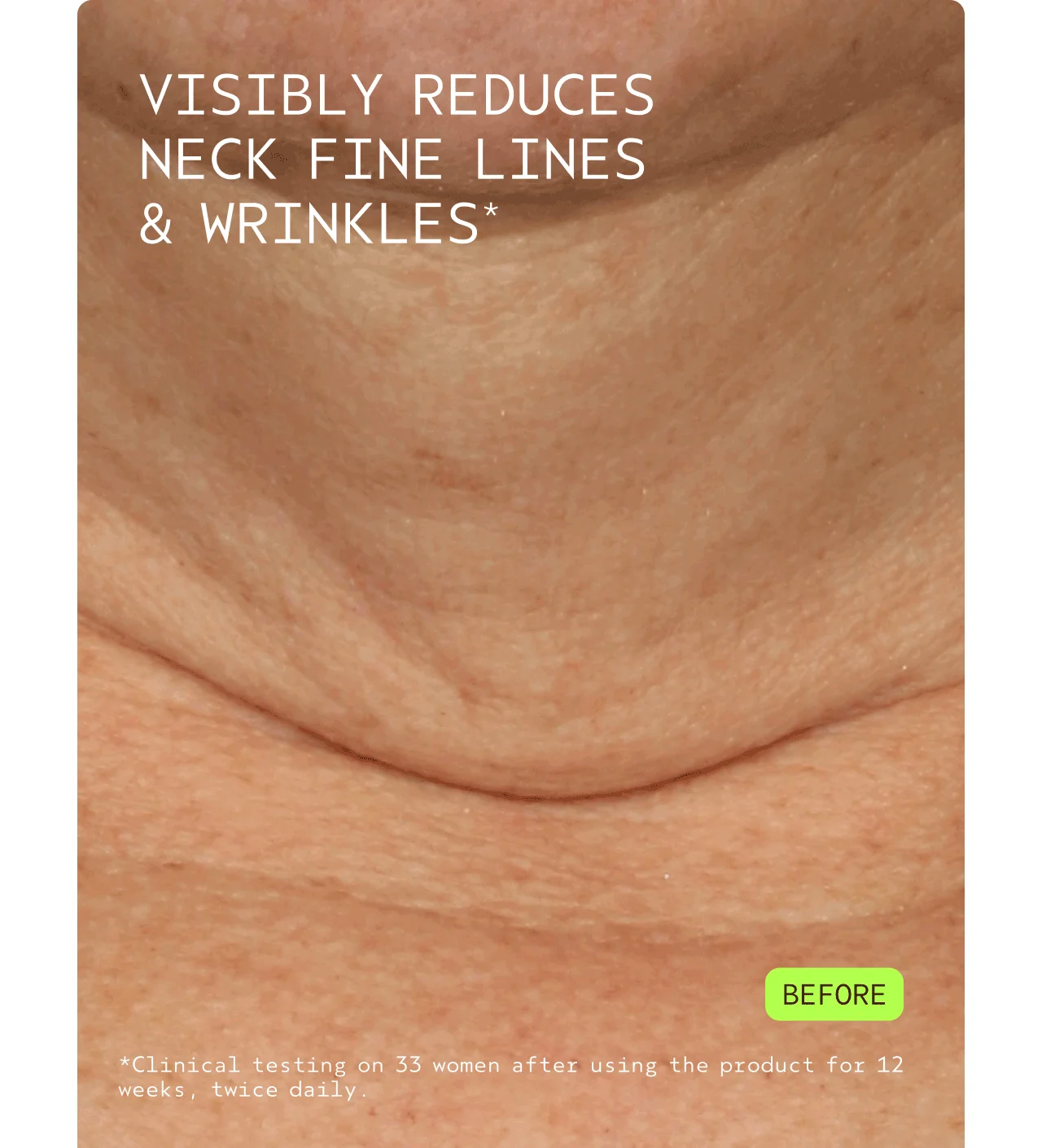 VISIBLY REDUCES NECK FINE LINES & WRINKLES