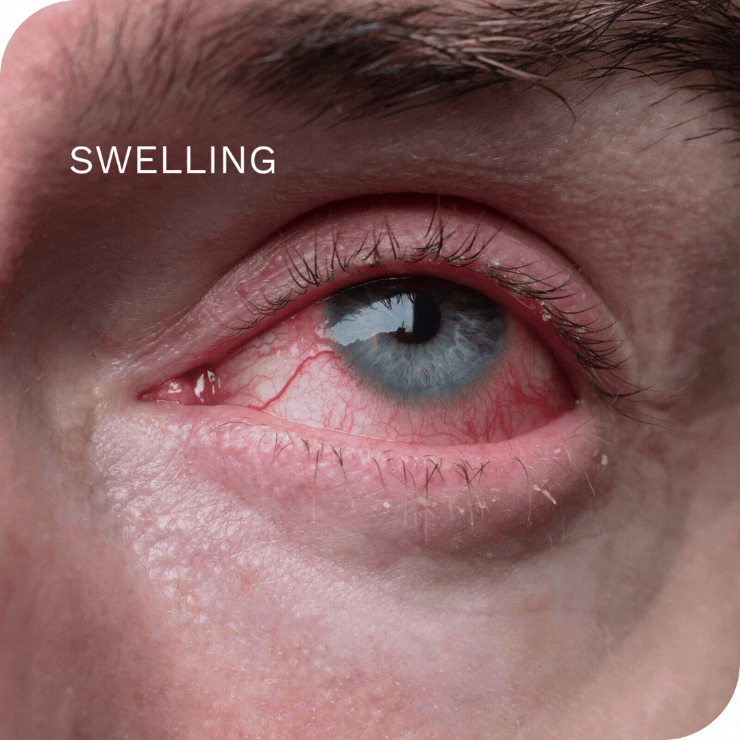 Find relief for your eyes!