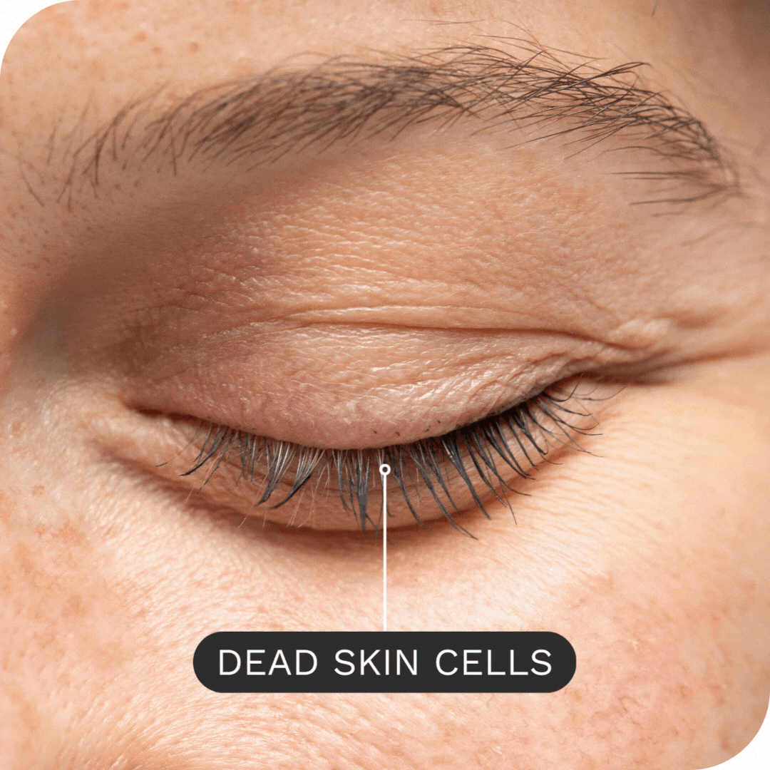 Clear out the eye crust!