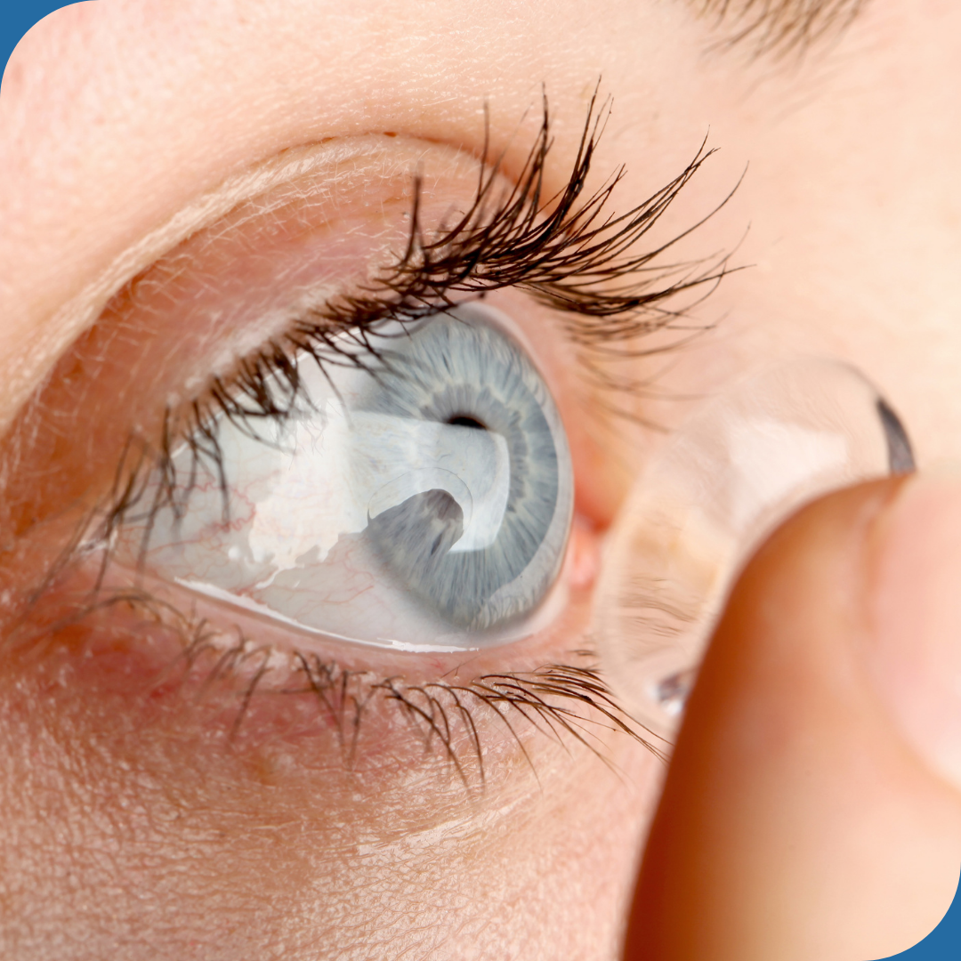 Contact Lens Intolerance
