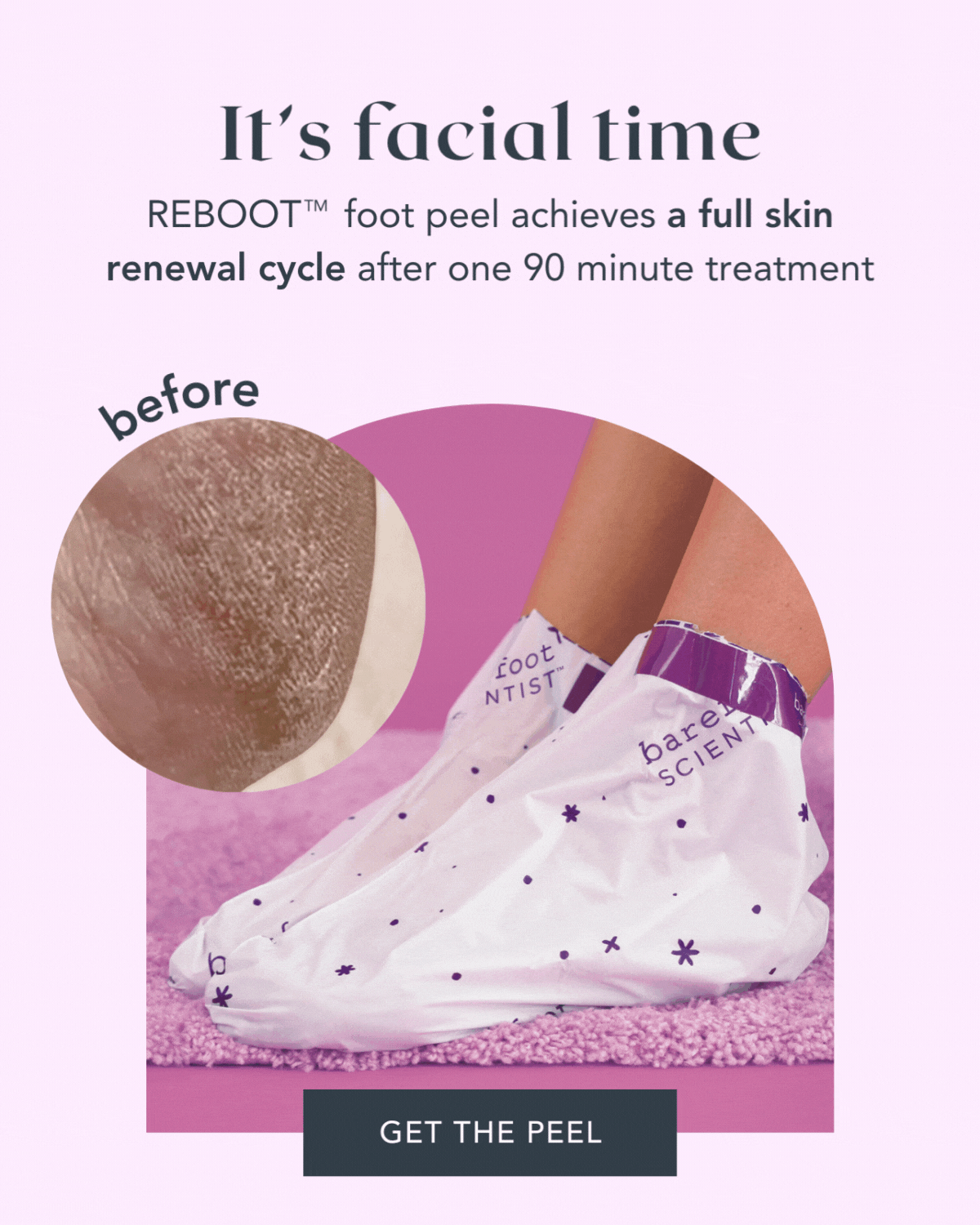 Reboot foot peel