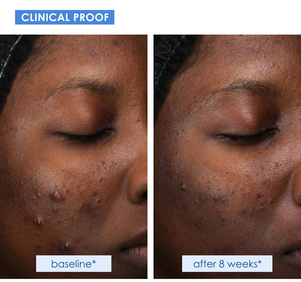 Obagi Retinol + PHA Refining Night Cream Test Result 1