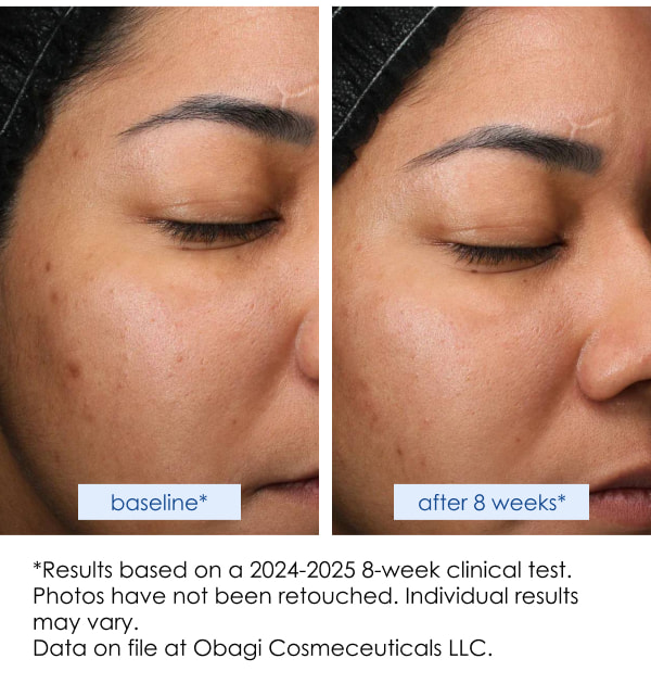 Obagi Retinol + PHA Refining Night Cream Test Result 2