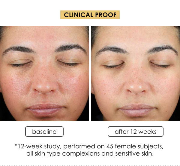 EltaMD UV Skin Recovery SPF 50. Test Result 1