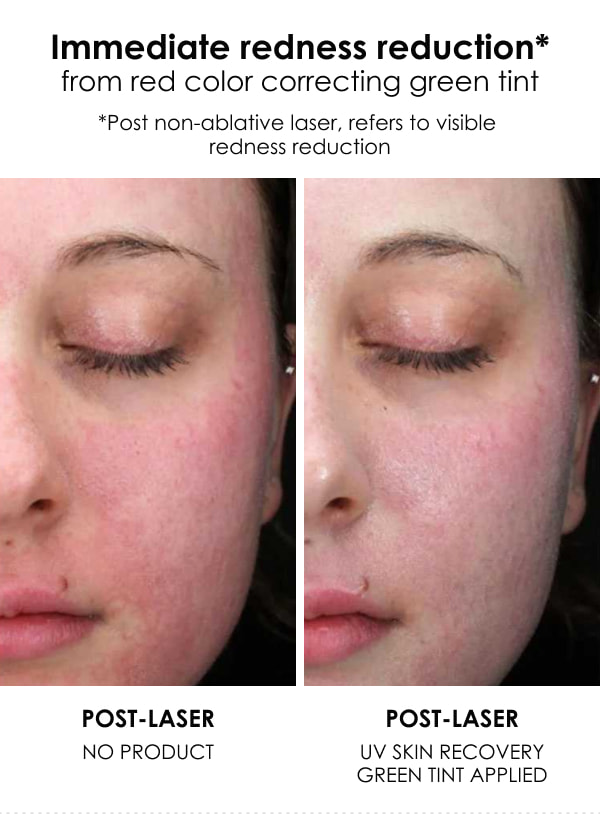 EltaMD UV Skin Recovery SPF 50. Test Result 2