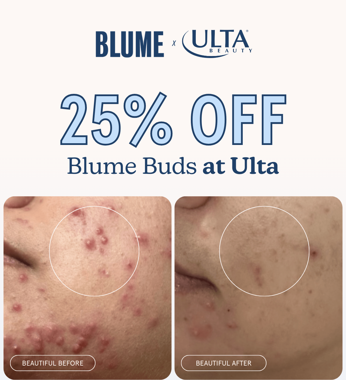 BLUME: 25% OFF Blume Buds at Ulta