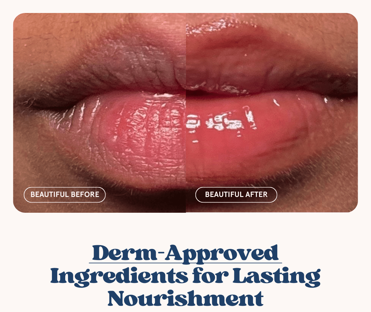 Derm-Approved Ingredients for Lasting Nourishment