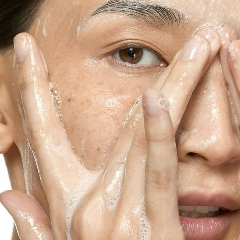 Normal skin