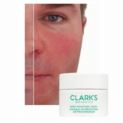 SHOP THE MASK