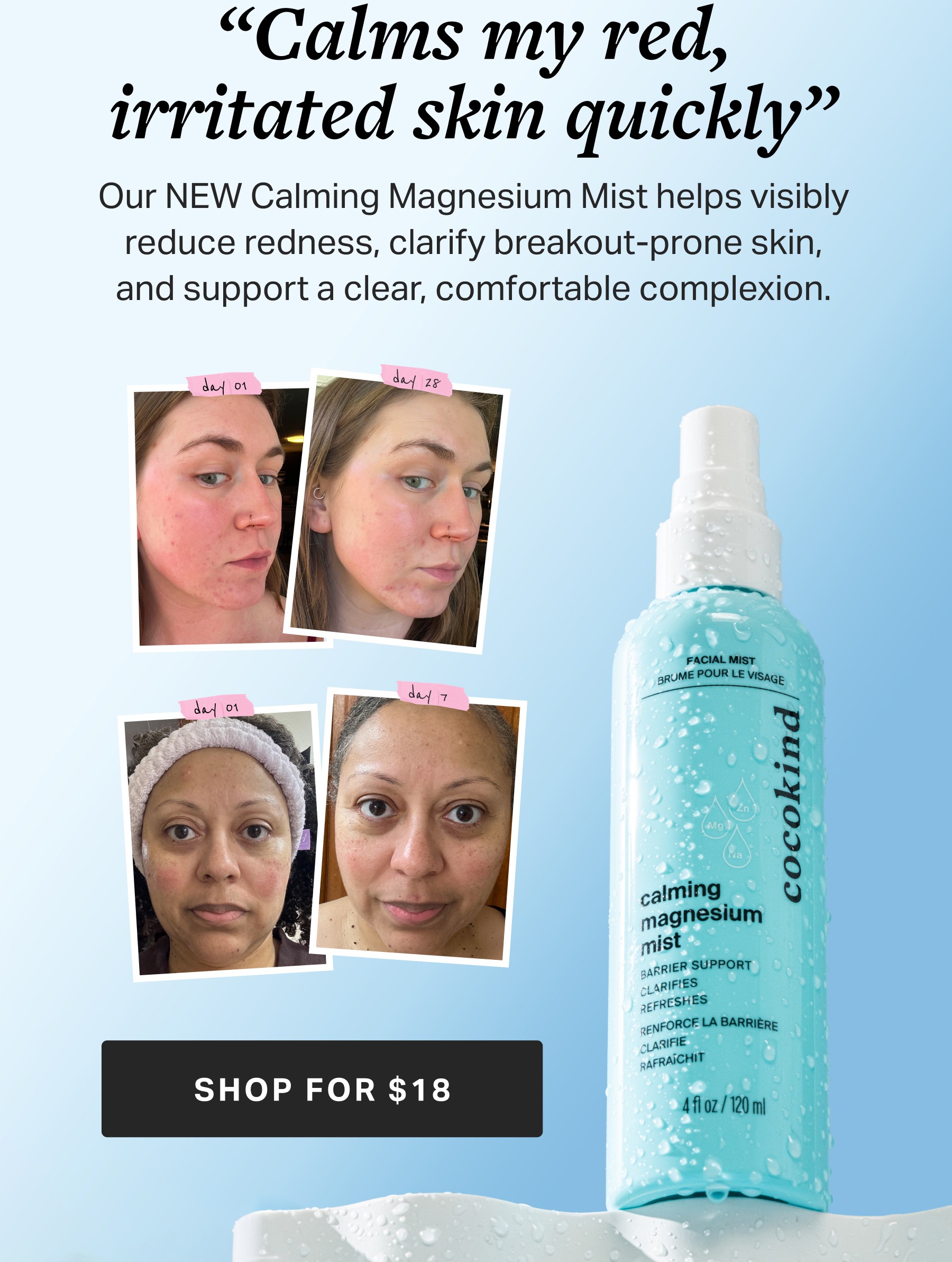 “Calms my red, irritated skin quickly”