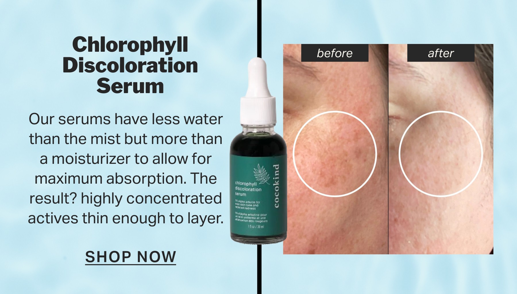 Chlorophyll Discoloration Serum