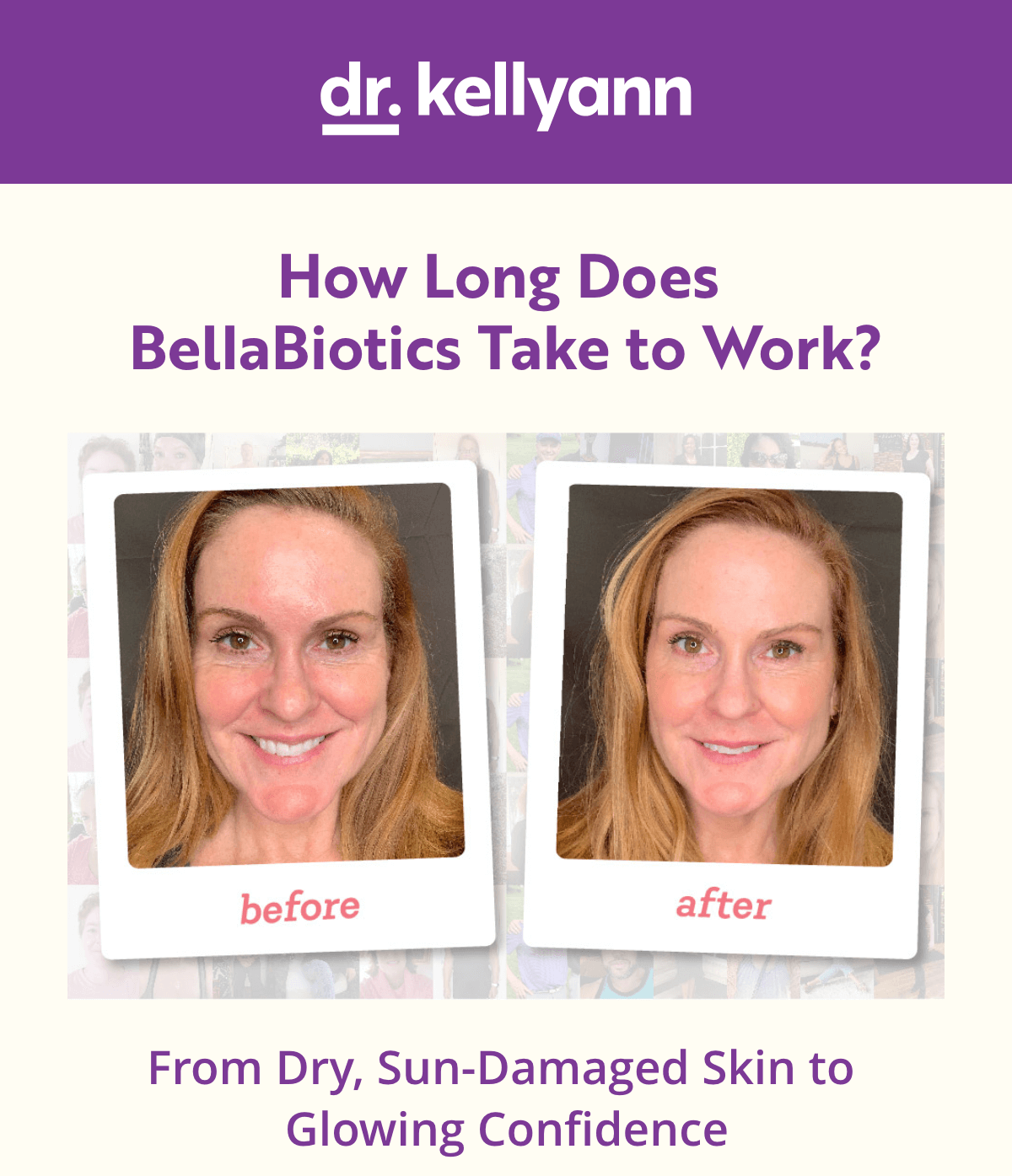 Dr. Kellyann - BellaBiotics