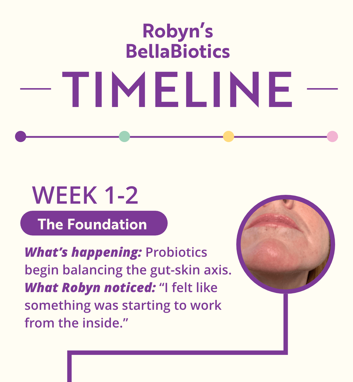 Dr. Kellyann - BellaBiotics