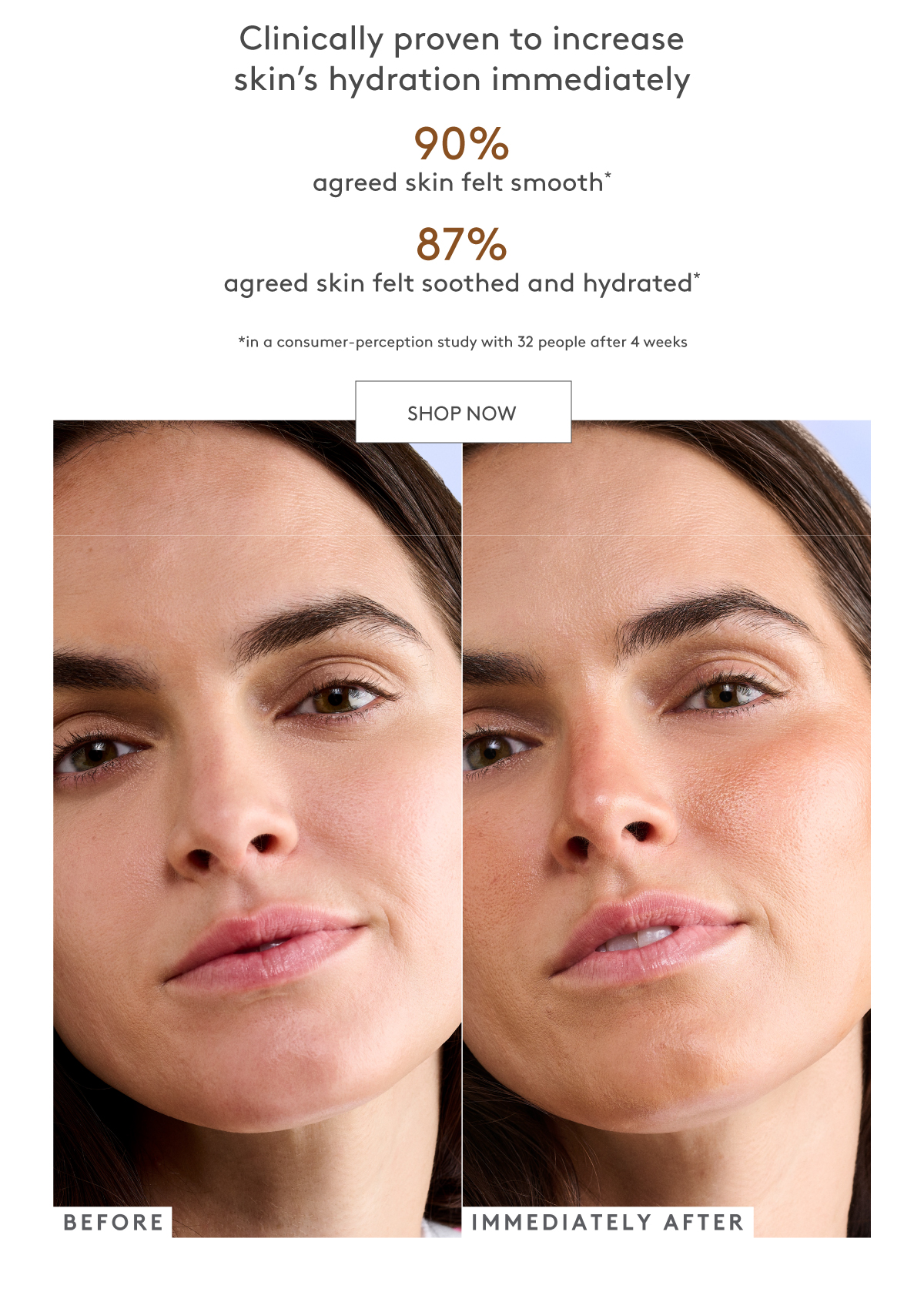 D-Bronzi Before & After