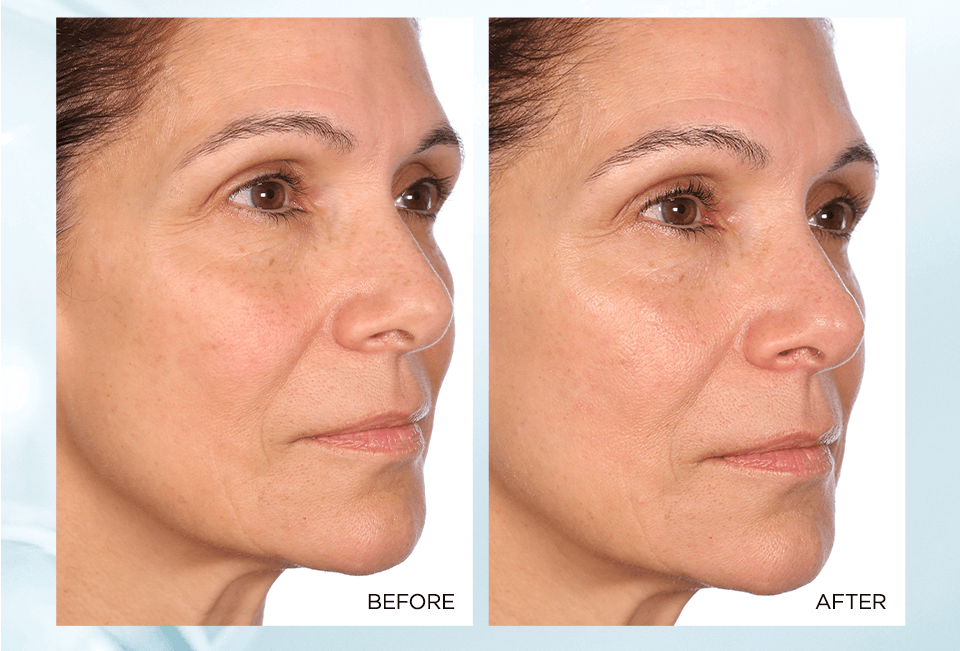 Skincare