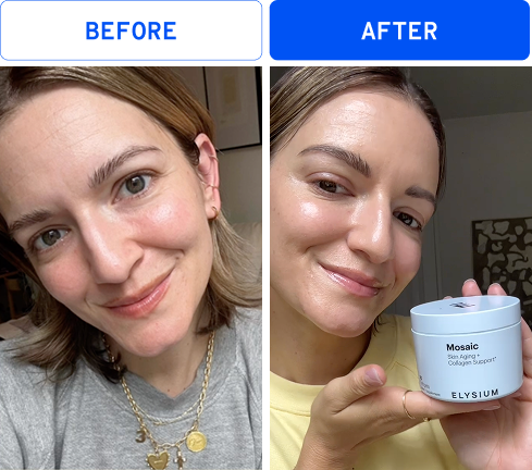 Before | After