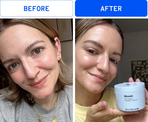 Before | After