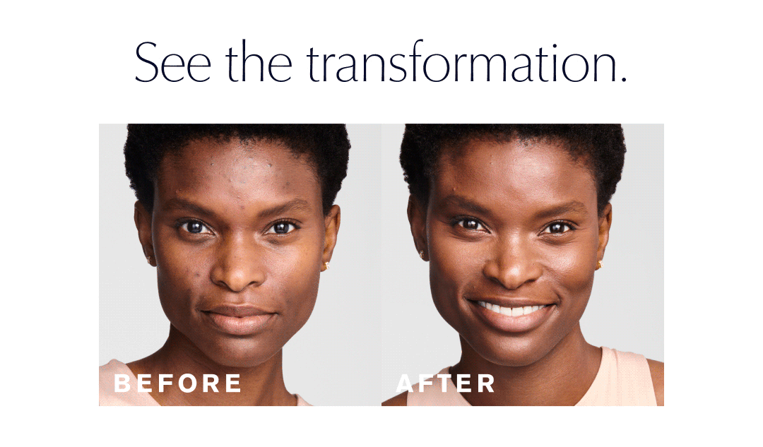 See the transformation 