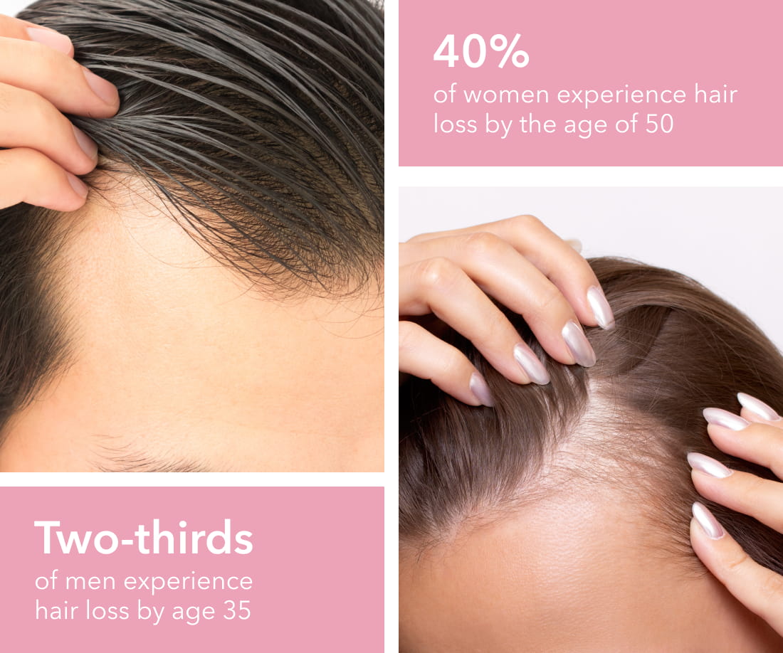 What causes hair loss?