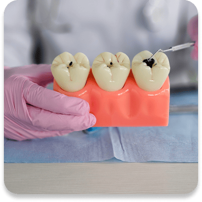 Plaque between teeth