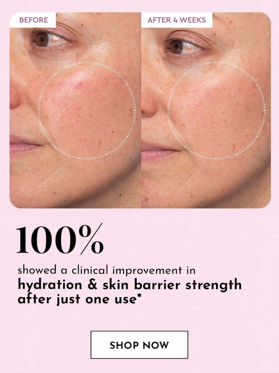 Prickly Pear Peptide Mucin