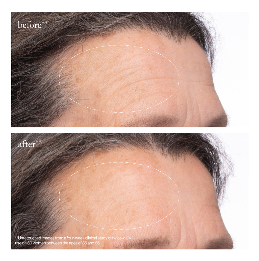 before and after:  the results after 4 weeks 