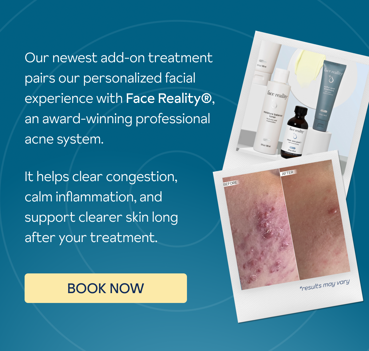 Book the Clarifying Acne Boost