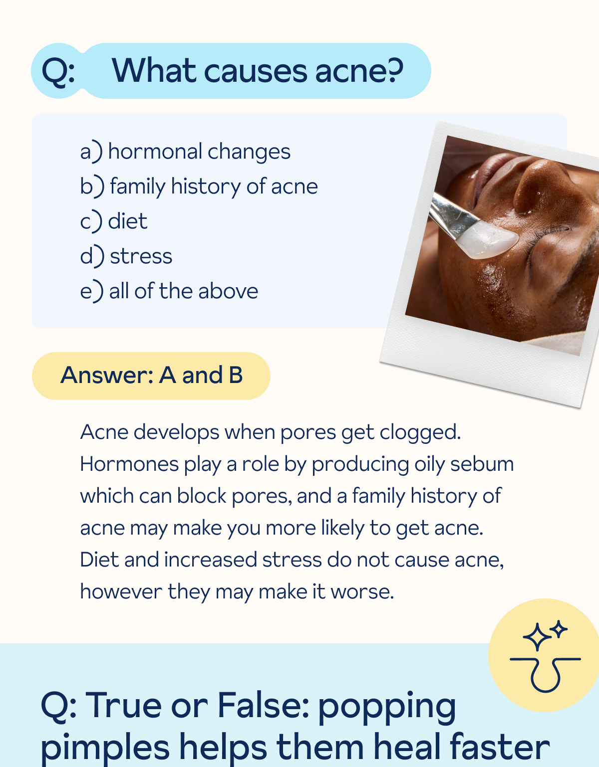 What causes acne?