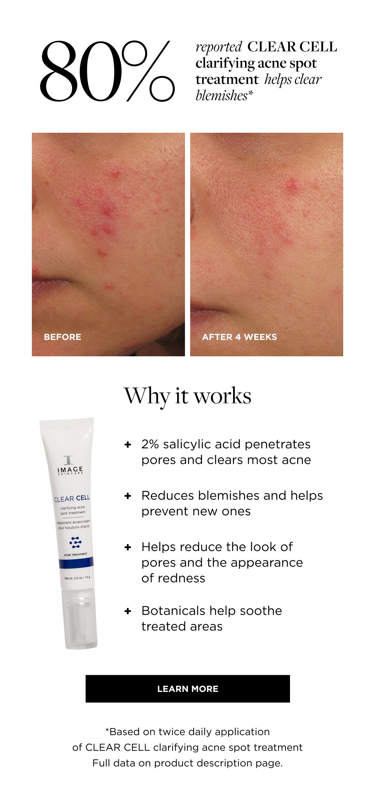 80% reported  CLEAR CELL clarifying acne spot treatment  helps clear blemishes* BEFORE AFTER 4 WEEKS Why it works + 2% salicylic acid penetrates pores and clears most acne + Reduces blemishes and helps prevent new ones + Helps reduce the look of pores and the appearance of redness + Botanicals help soothe treated areas  learn more *Based on twice daily application of CLEAR CELL clarifying acne spot treatment Full data on product description page.