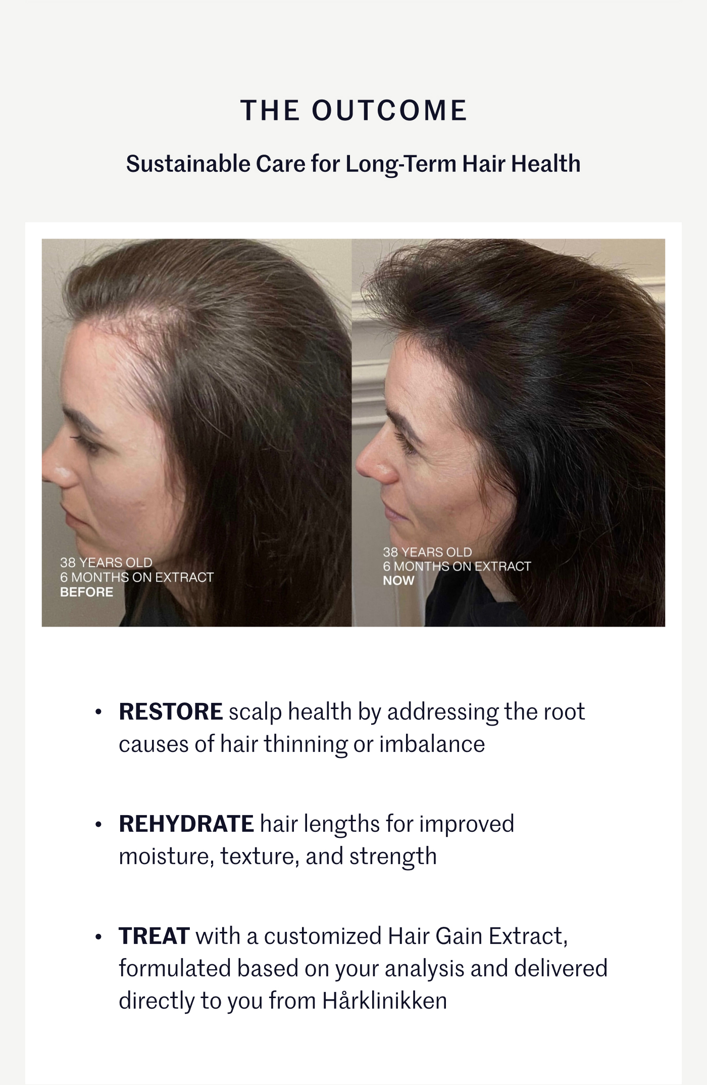 The Outcome Sustainable Care for Long-Term Hair Health  —Restore scalp health by addressing the root causes of hair thinning or imbalance – Rehydrate hair lengths for improved moisture, texture, and strength – Treat with a customized Hair Gain Extract, formulated based on your analysis and delivered directly to you from Hårklinikken