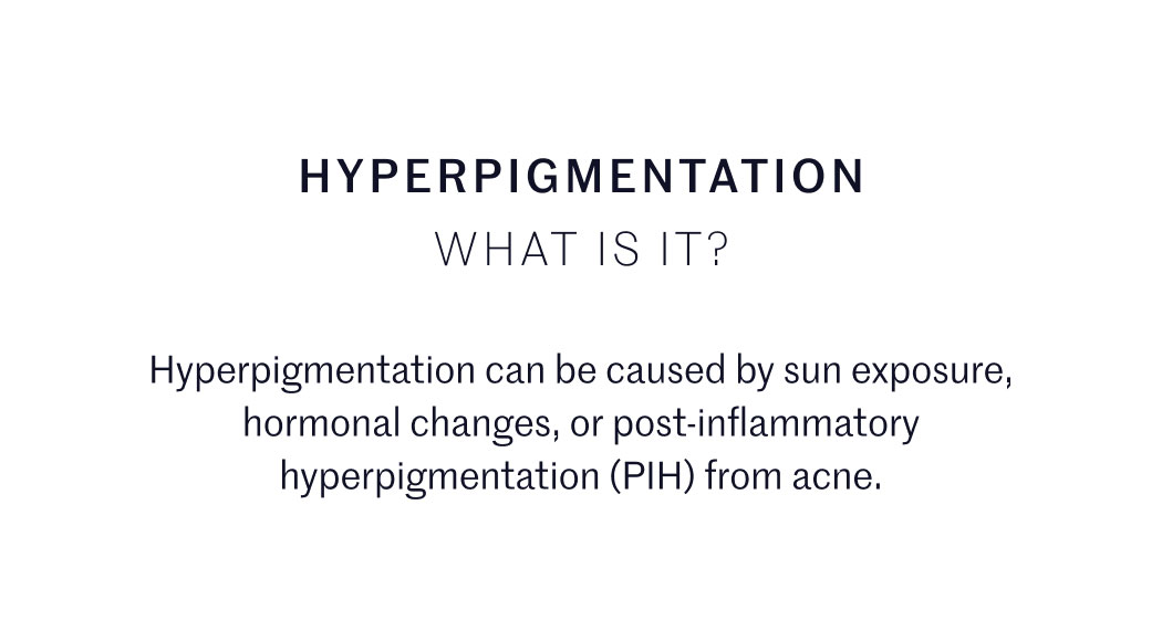 HYPERPIGMENTATION WHAT IS IT?  Hyperpigmentation can be caused by sun exposure, hormonal changes, or post-inflammatory hyperpigmentation (PIH) from acne.