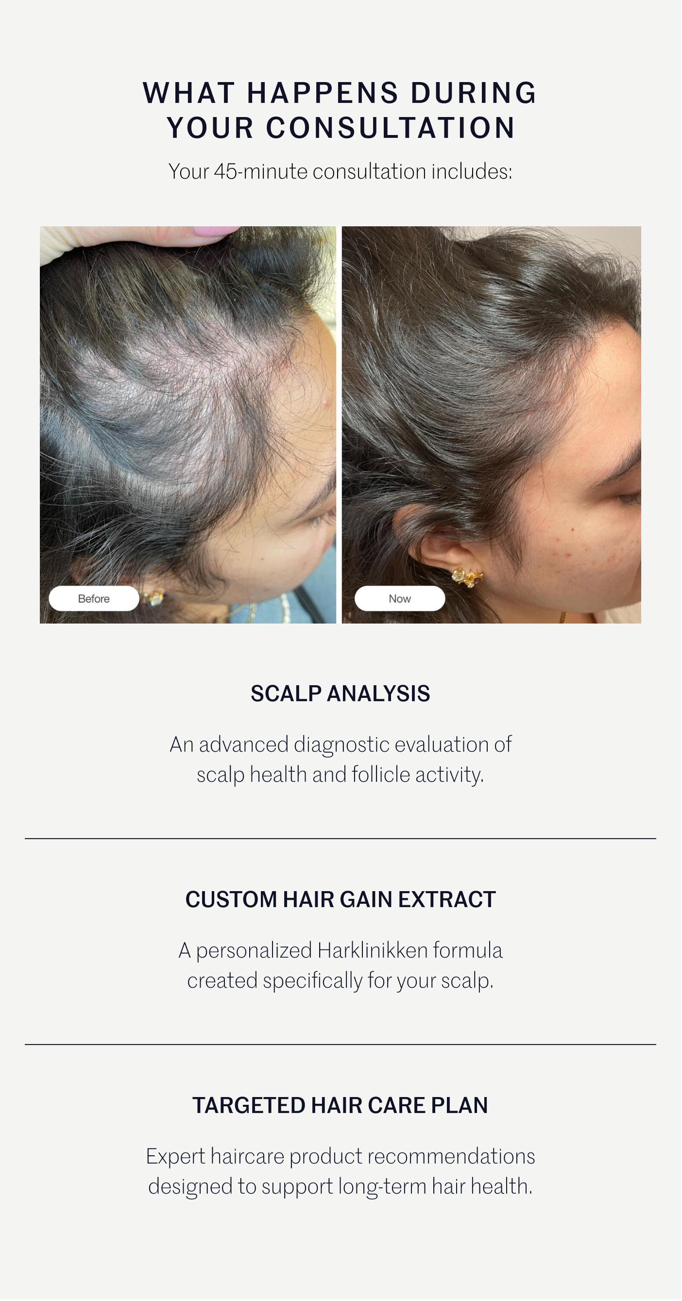 WHAT HAPPENS DURING YOUR CONSULTATION  Your 45-minute consultation includes: SCALP ANALYSIS An advanced diagnostic evaluation of scalp health and follicle activity.  CUSTOM HAIR GAIN EXTRACT A personalized Harklinikken formula created specifically for your scalp.  TARGETED HAIR CARE PLAN Expert haircare product recommendations designed to support long-term hair health.