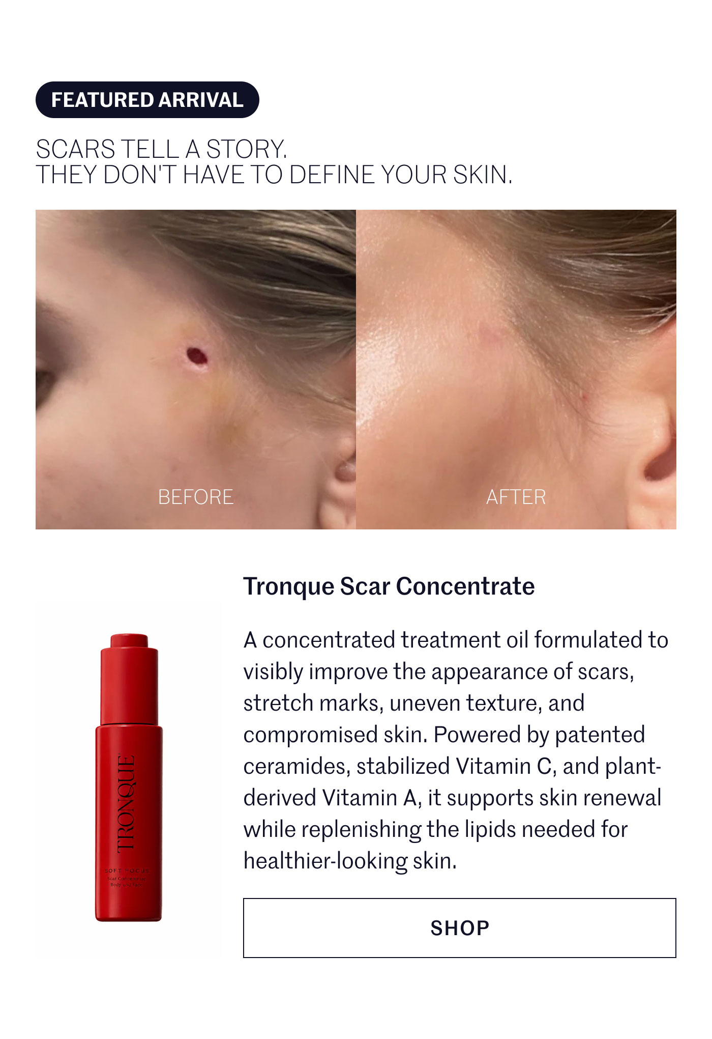 FEATURED ARRIVAL  SCARS TELL A STORY. THEY DON'T HAVE TO DEFINE YOUR SKIN.  Tronque Scar Concentrate  A concentrated treatment oil formulated to visibly improve the appearance of scars, stretch marks, uneven texture, and compromised skin. Powered by patented ceramides, stabilized Vitamin C, and plant-derived Vitamin A, it supports skin renewal while replenishing the lipids needed for healthier-looking skin.  SHOP