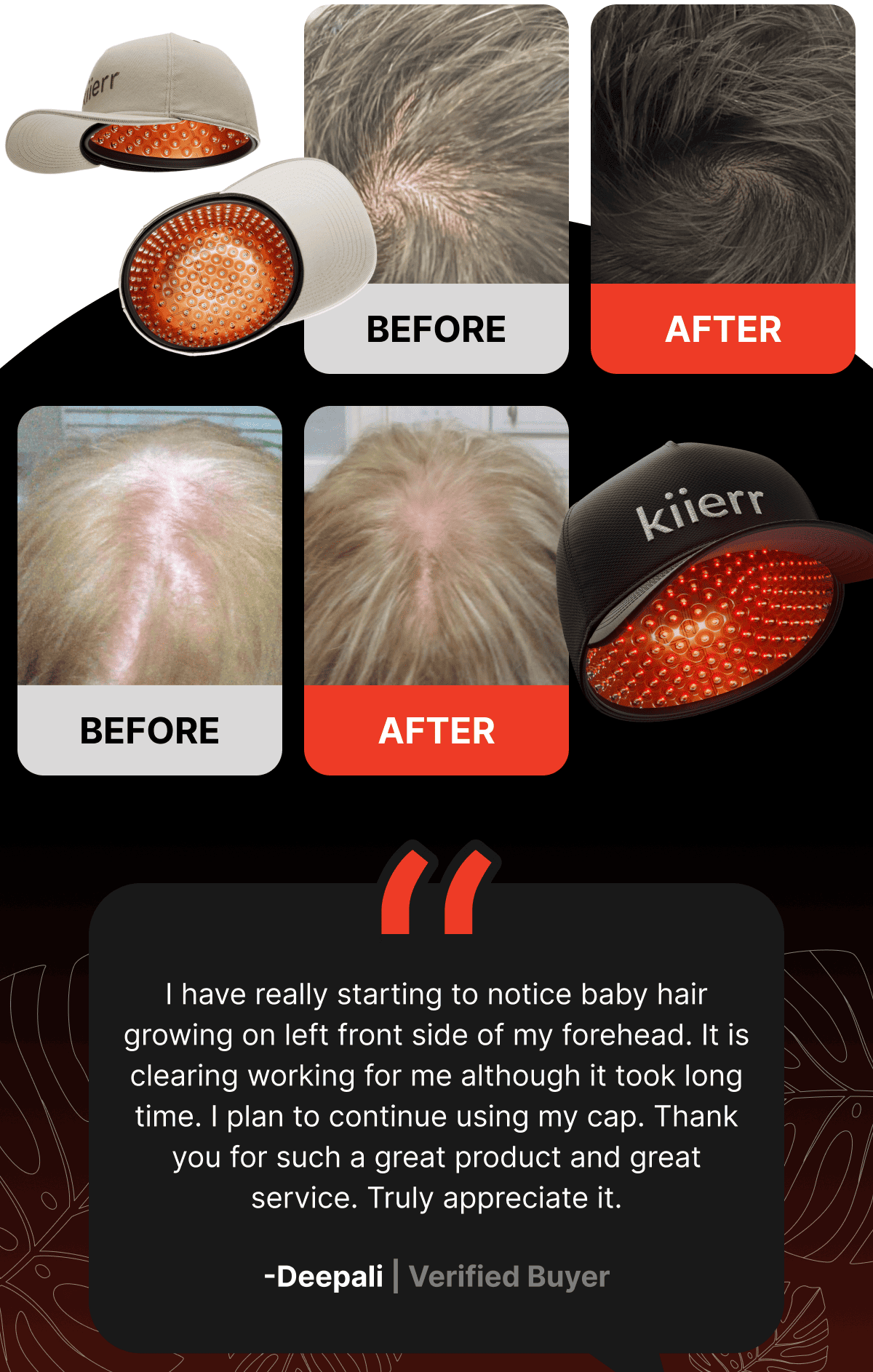 Before / After