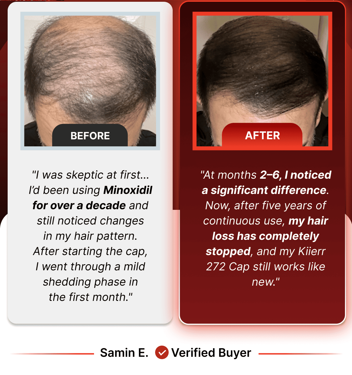 Before / After