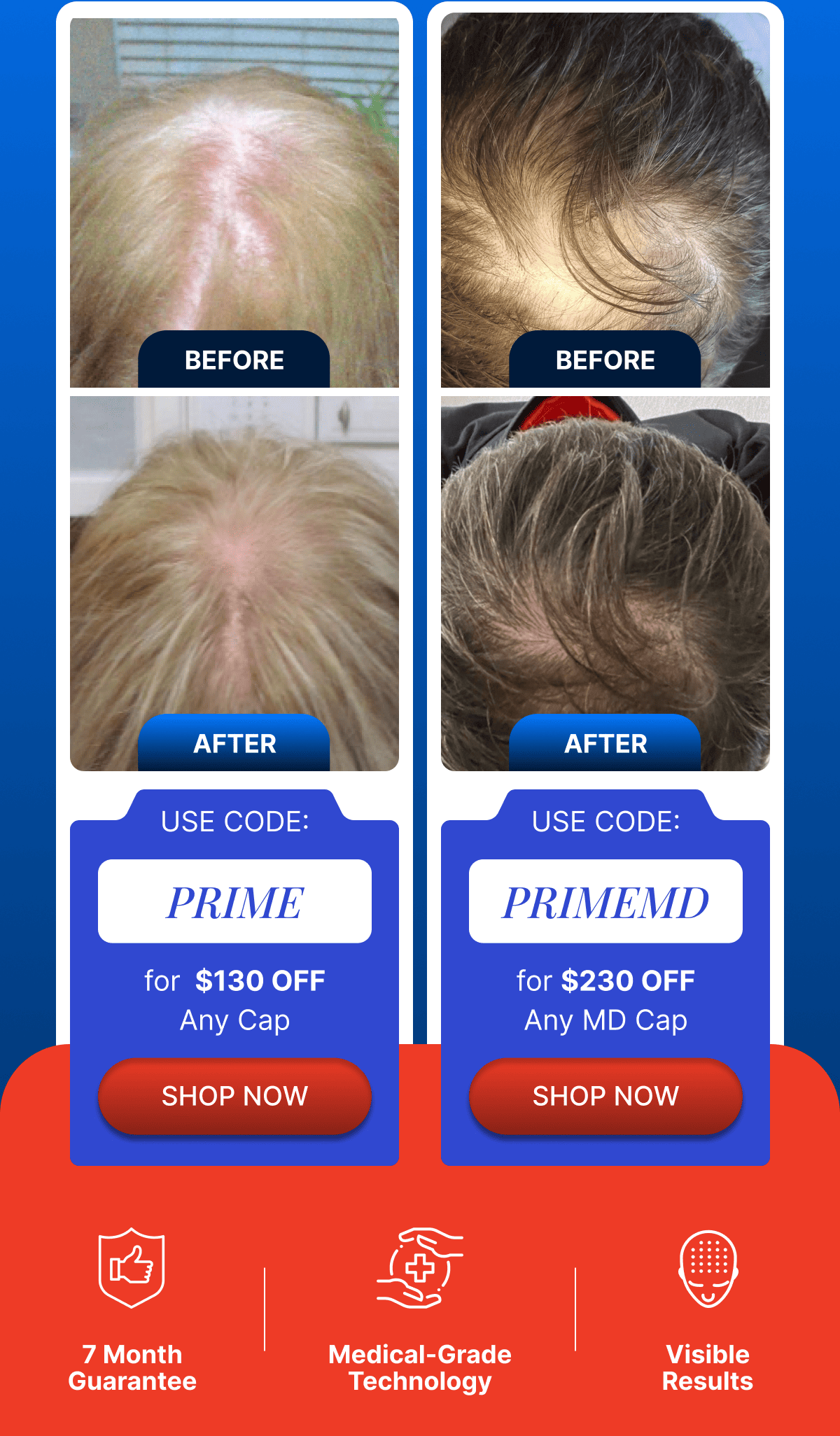 Before / After