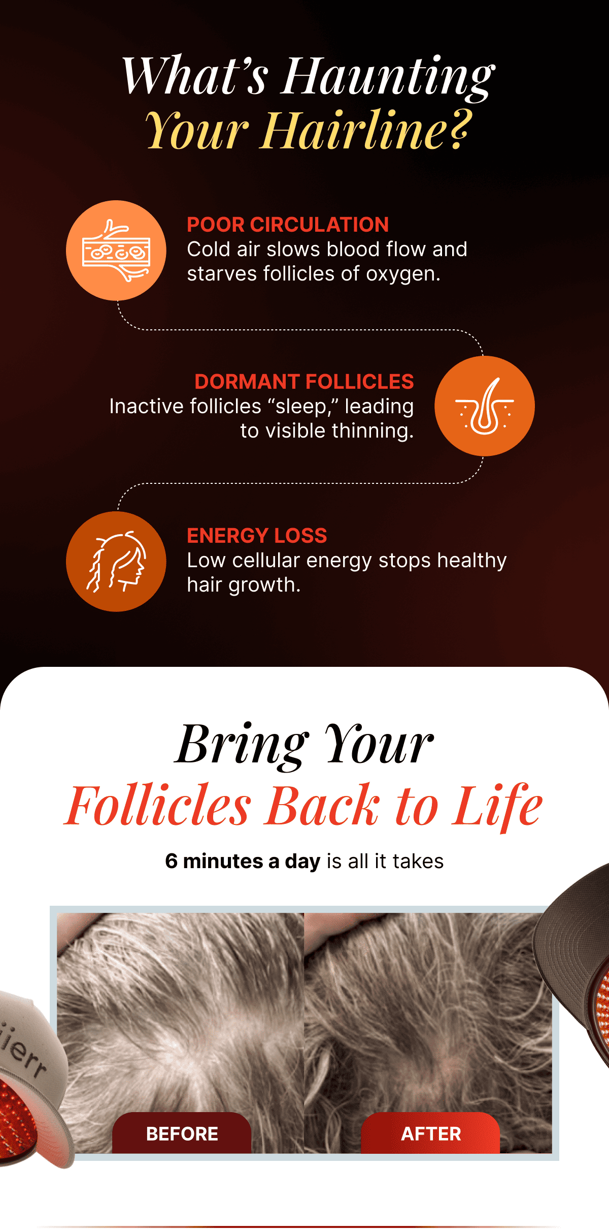 What's Haunting Your Hairline?