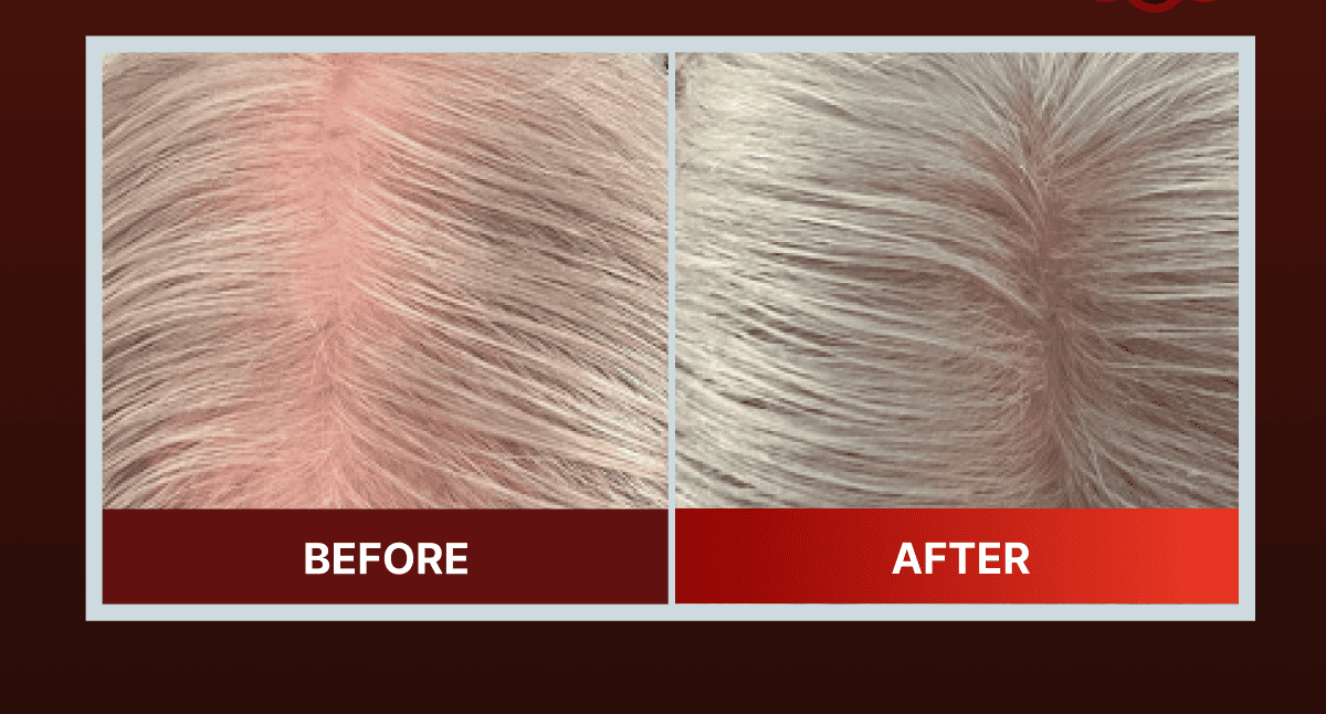 Before / After