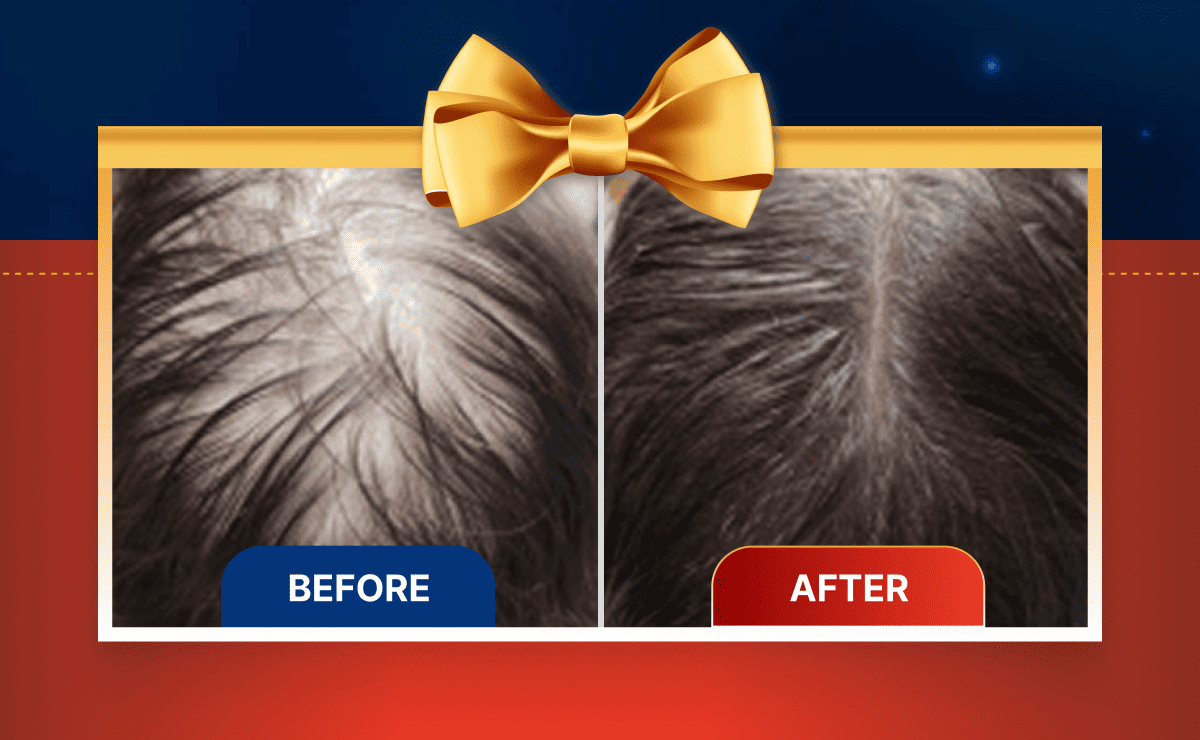 Before/After