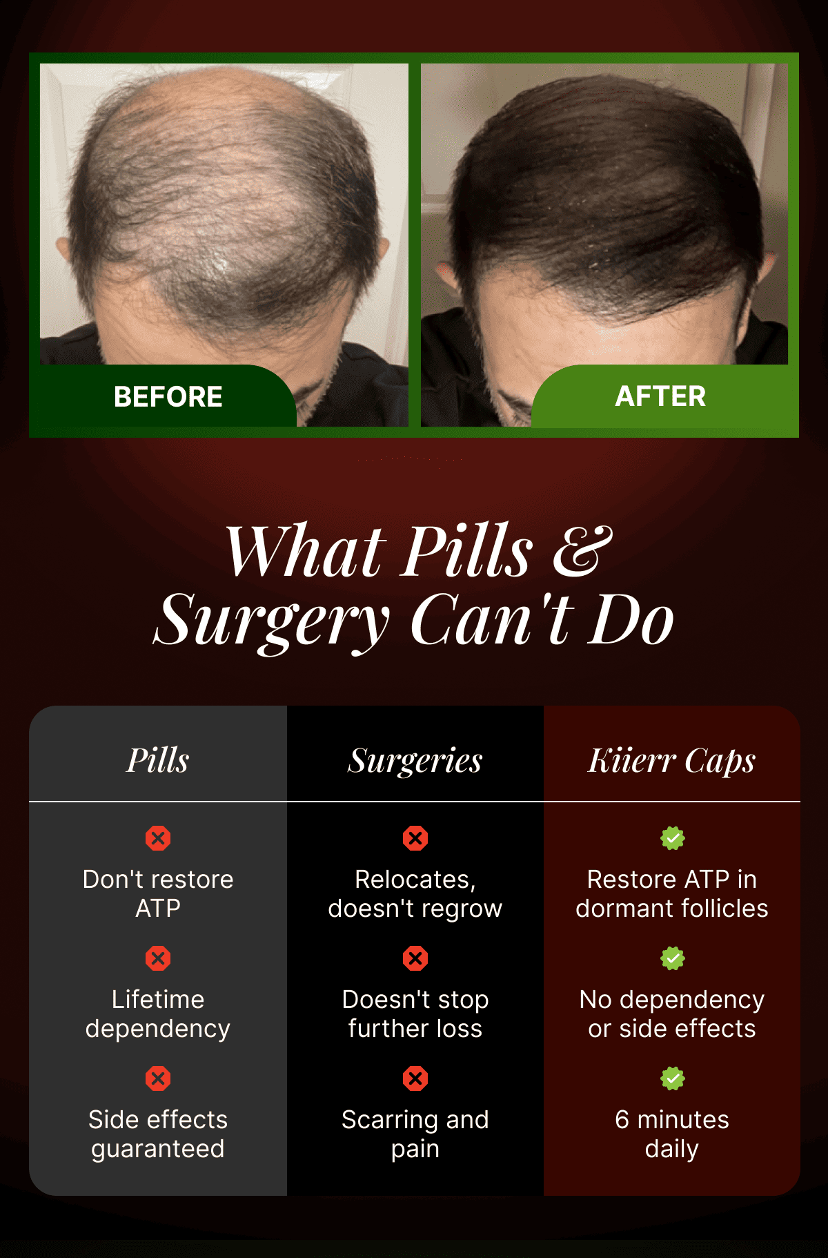 Before / After