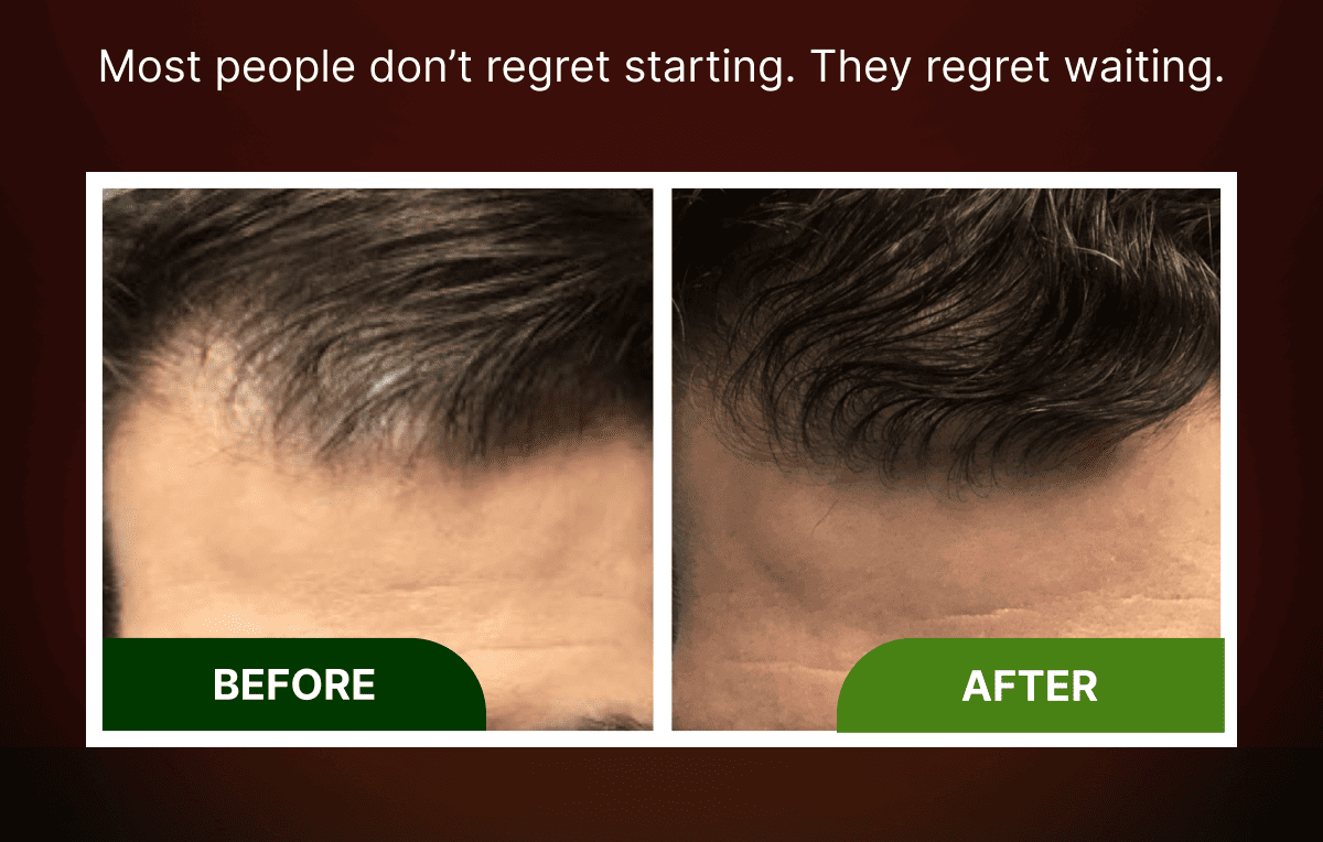 Before / After