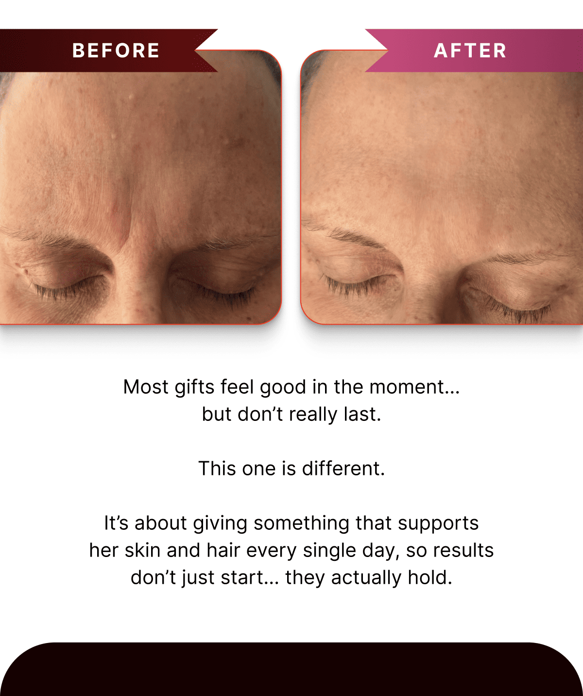 Before / After