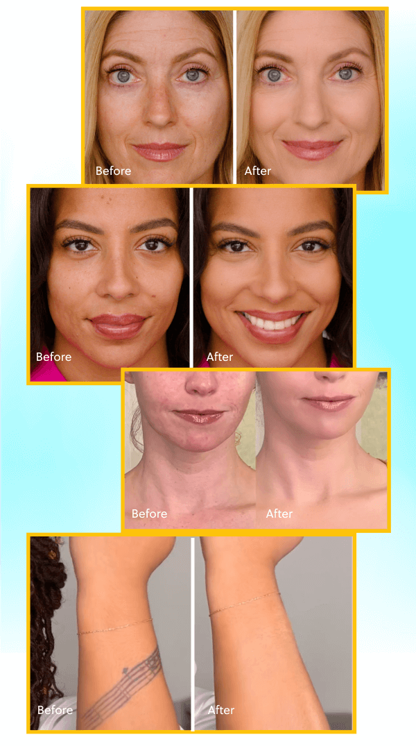 Foundation Kit