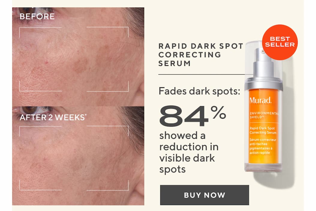 Rapid Dark Spot Correcting Serum