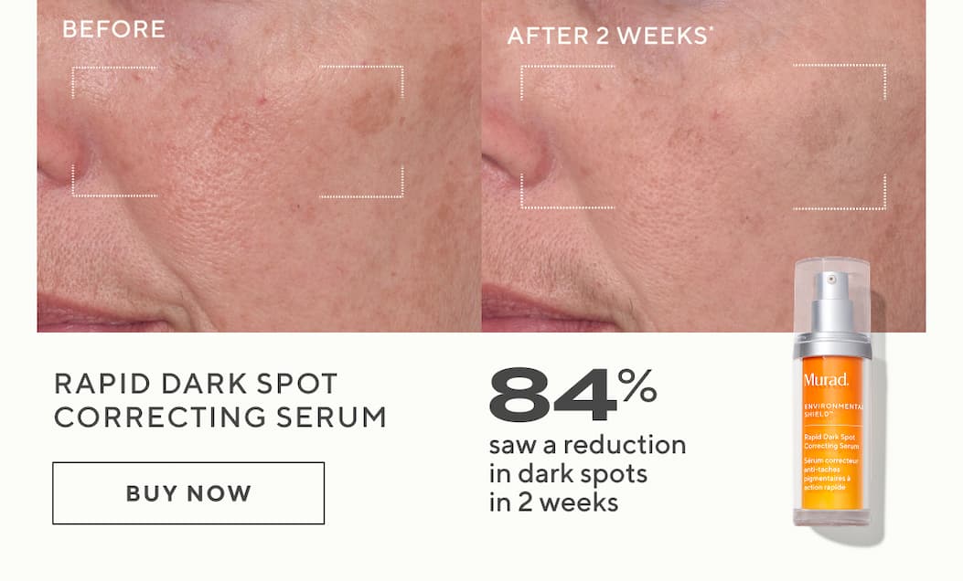 Rapid Dark Spot Correcting Serum