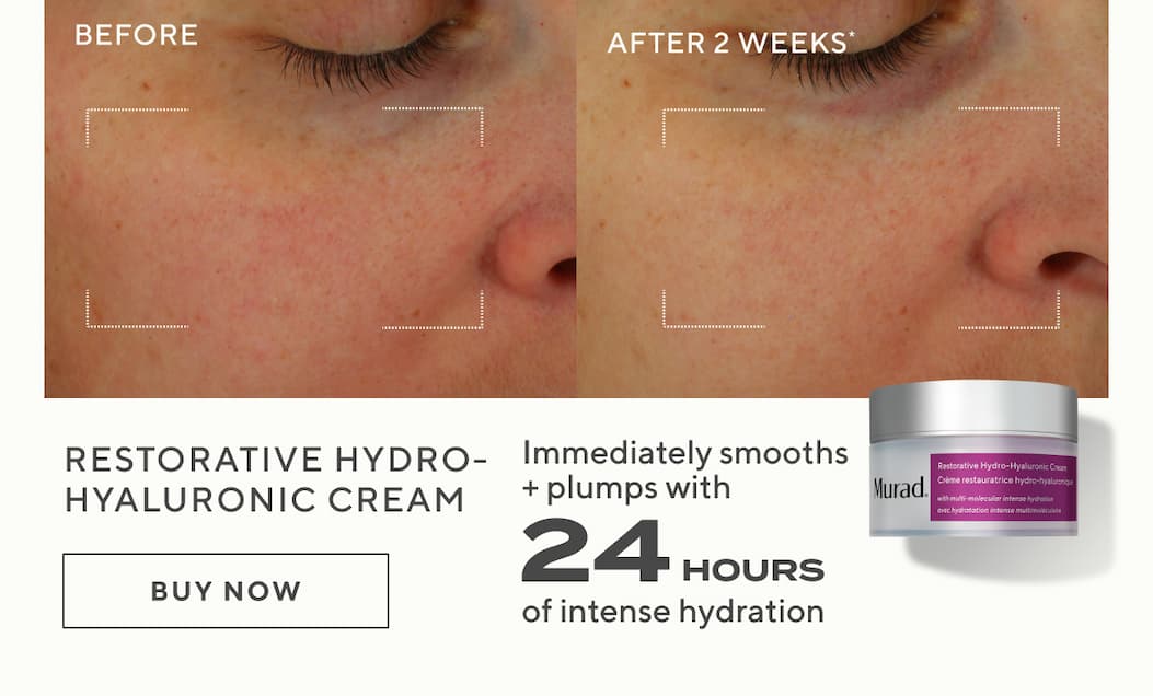 Restorative Hydro-Hyaluronic Cream