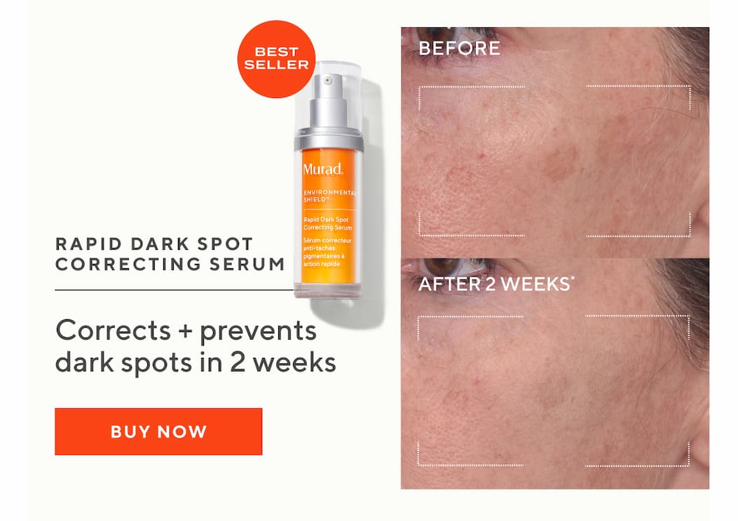 Rapid Dark Spot Correcting Serum