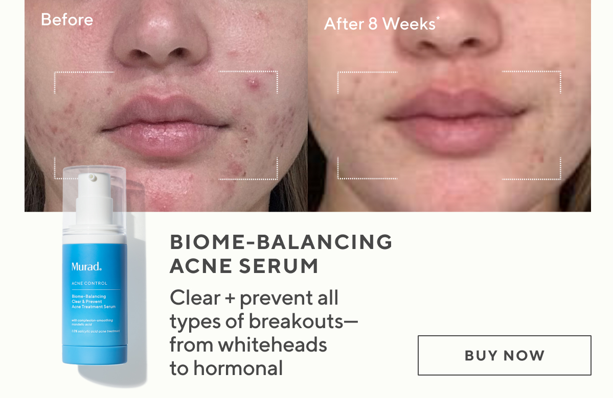 Biome-Balancing Acne Serum